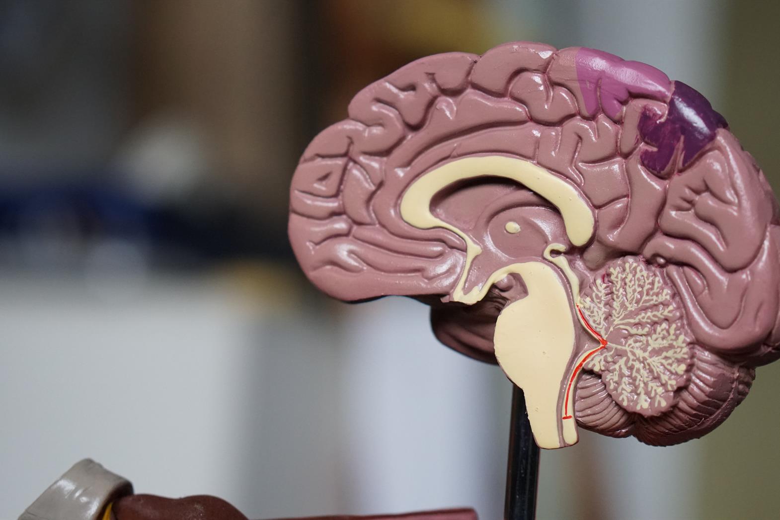 A model of a brain